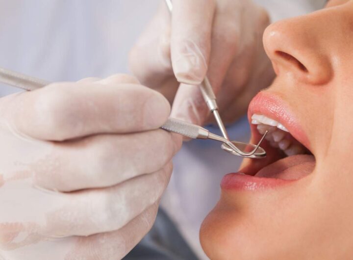 quali cure dentista gratis